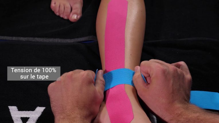 Périostite tibiale et douleur au tibia : analyse des symptômes et traitements