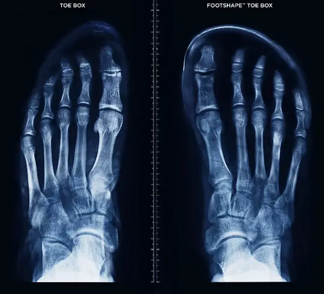 Les chaussures large vs étroites pour courir : vision de la toebox altra VS classique