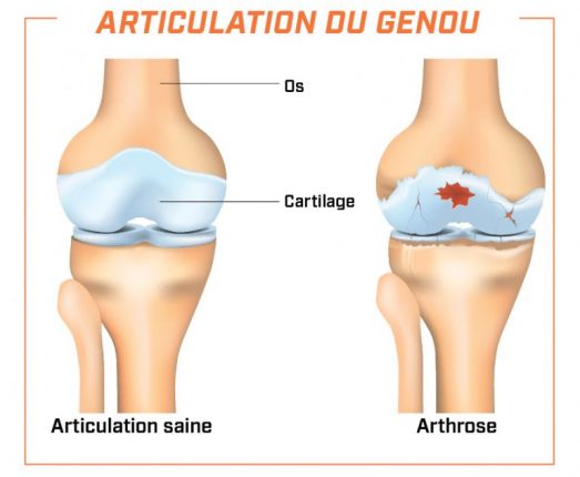 Courir fait vivre plus longtemps en bonne santé (prouvé par la science)