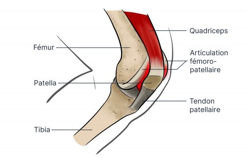 syndrome femoro-patellaire