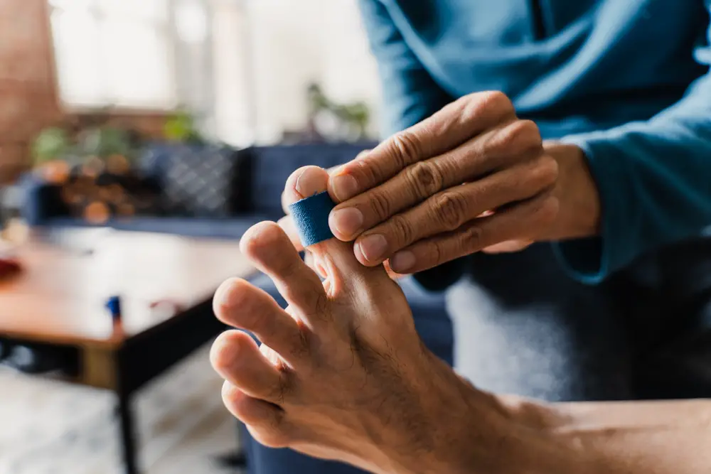 Ampoules en course à pied : Comment les éviter / les traiter ?