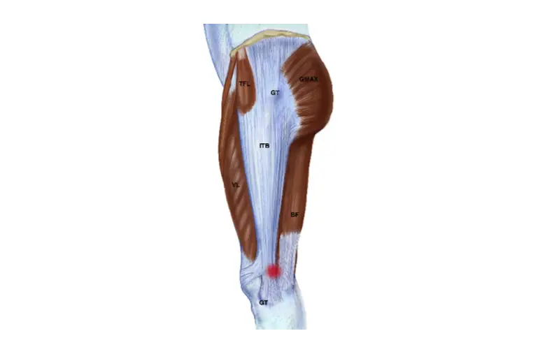 schema-jambe-syndrome-essui-glace